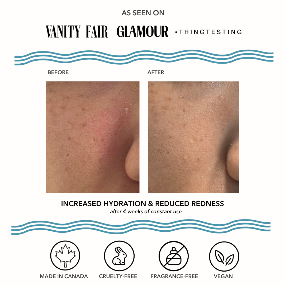 Hyd. Vacation Skin Redness Recovery Overnight Mask and Moisturizer